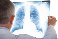 COPD Entstehung COPD Ursachen