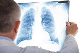 COPD Entstehung COPD Ursachen